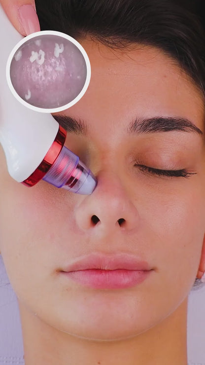 Pore Cleaning Device